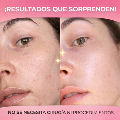 Recupera la luminosidad y firmeza de tu piel en semanas